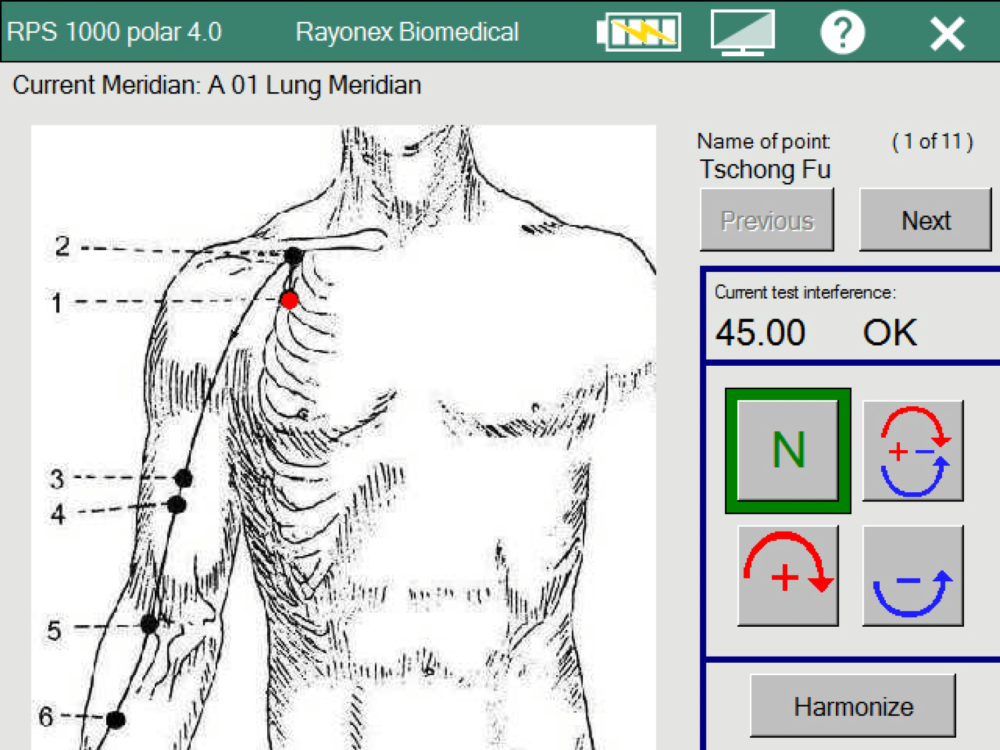 Rayoscan® software add-on: acupuncture analysis
